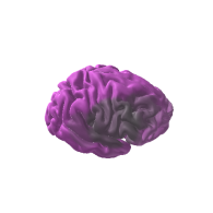 3d model - Disseased Brain
