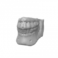 3d model - teeth